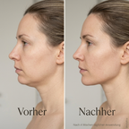 Kollafine Face Wrap