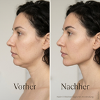 Kollafine Face Wrap